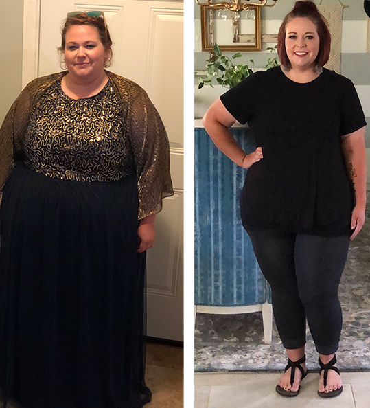 Meet Grace | Panhandle Weight Loss Center