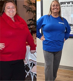Brandi's weight loss transformation