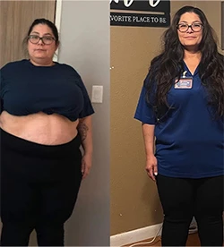 Lorena's weight loss transformation